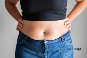 Bidding Farewell to Muffin Tops with Aqualyx Fat Injections 2 Do you wish you could reduce your muffin top Underwood With Aqualy fat dissolving injections you can!